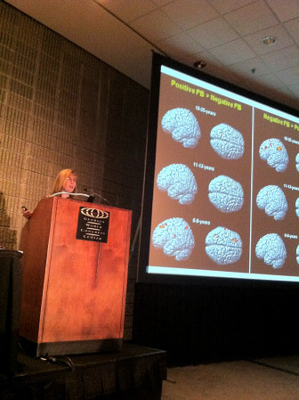 Elizabeth Cauffman shows a group of lawmakers brains in various stages of development. 
