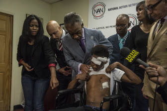 Javier Payne and his family joined Rev. Al Sharpton at the national Action Headquarters in Harlem Saturday morning  to call for swift justice in the recent incident involving the NYPD. Rev Al Sharpton lifts Javier's shirt to show his wounds.