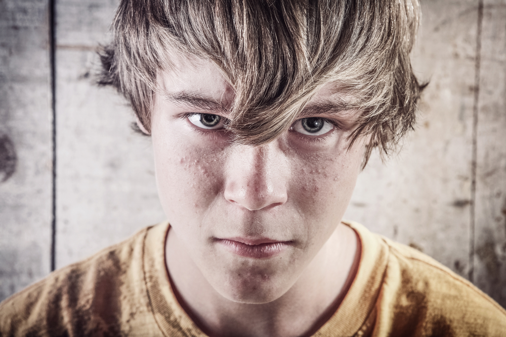prevention: angry teen with light brown hair over face, mustard yellow shirt